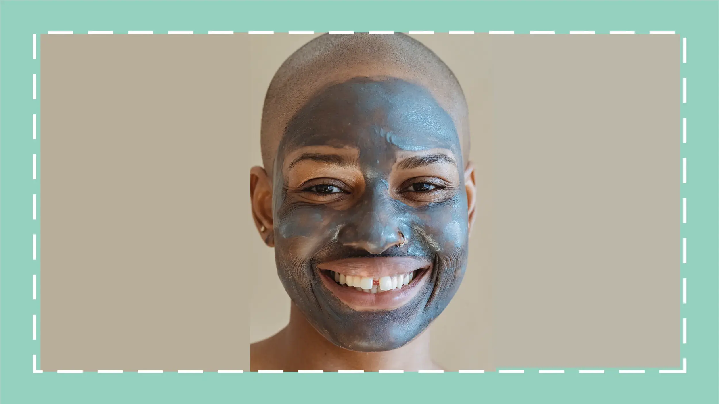 7 Times You Should See a Dermatologist for Your Acne Illustrations