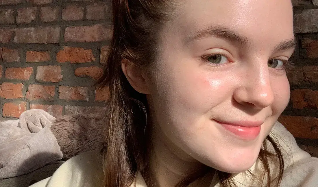 How Eating Clean For One Week Improved My Acne-Prone Skin Illustrations