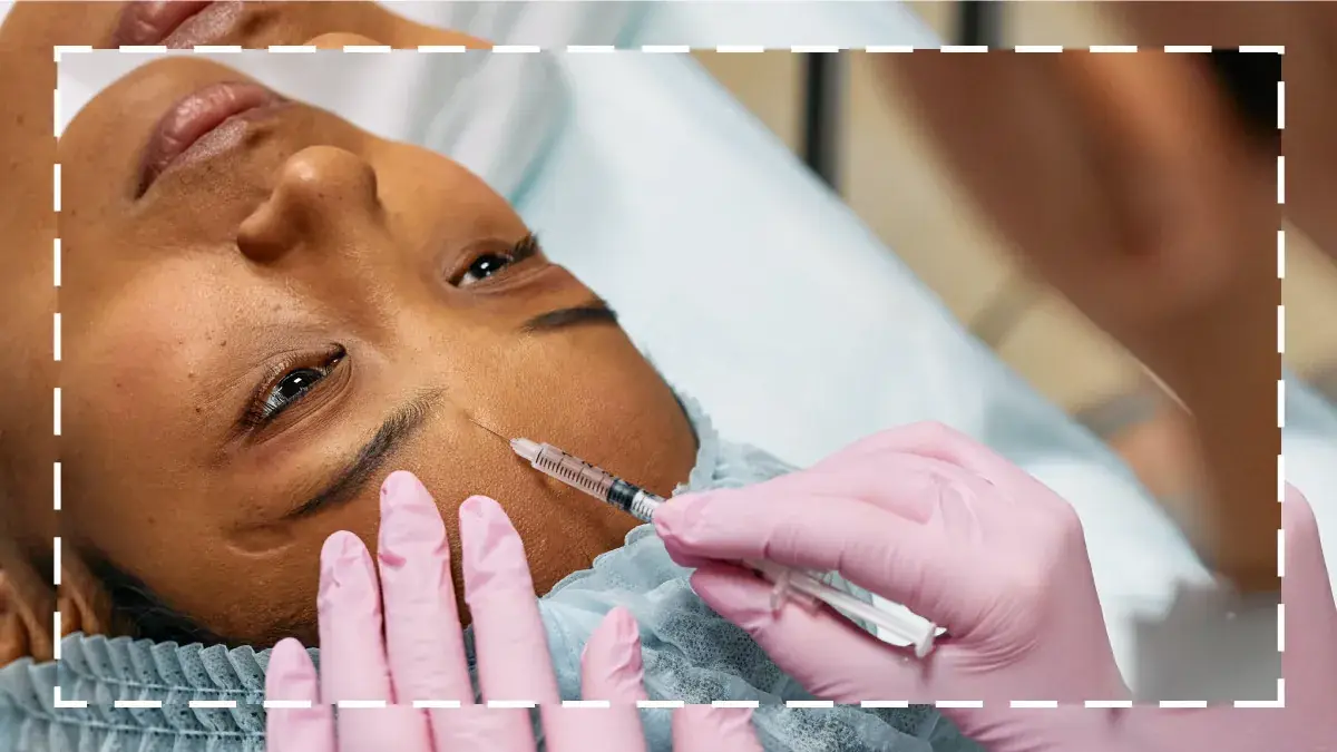 Everything You Need to Know About “Baby Botox” Illustrations