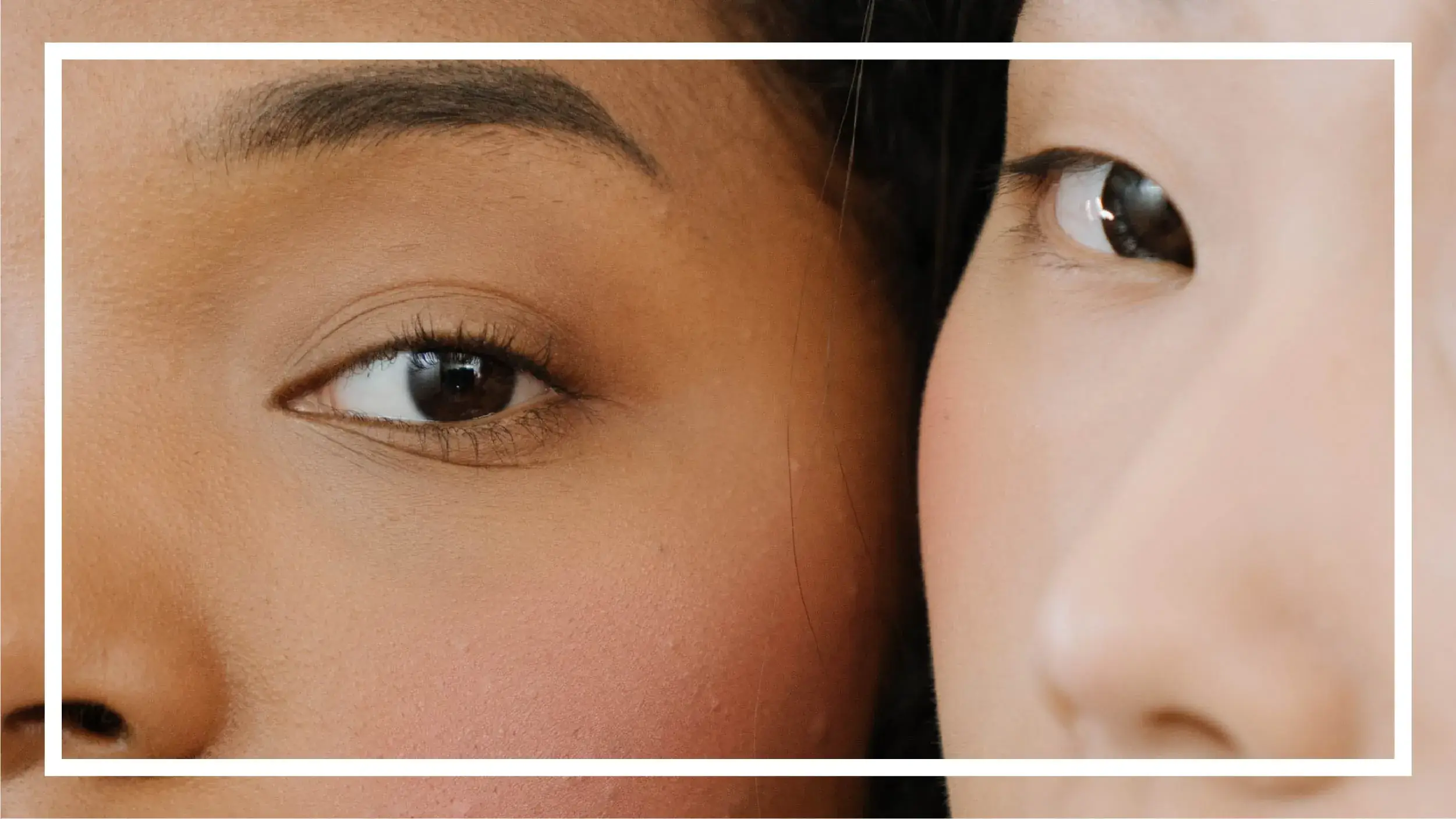 Everything You Need To Know About Why Winter Acne Is So Stubborn Illustrations