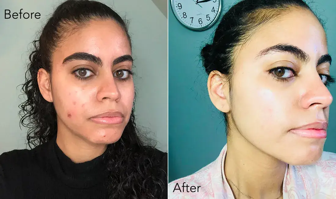 The Korean Skin Care Serum That Saved My Face From a Traumatic Facial Scar Illustrations