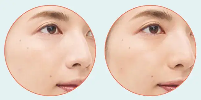 コンシーラーは「手」ではなく「ブラシ」を使う