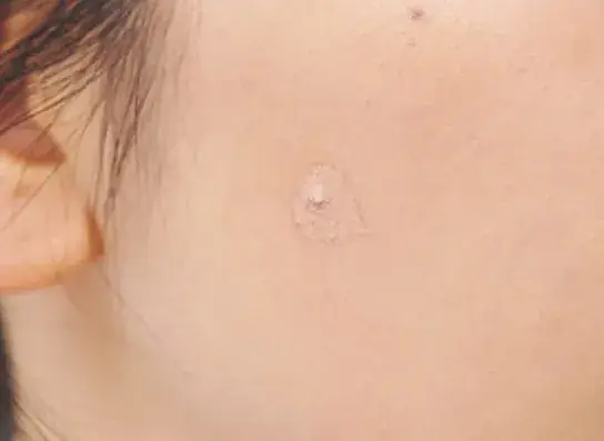 手順1