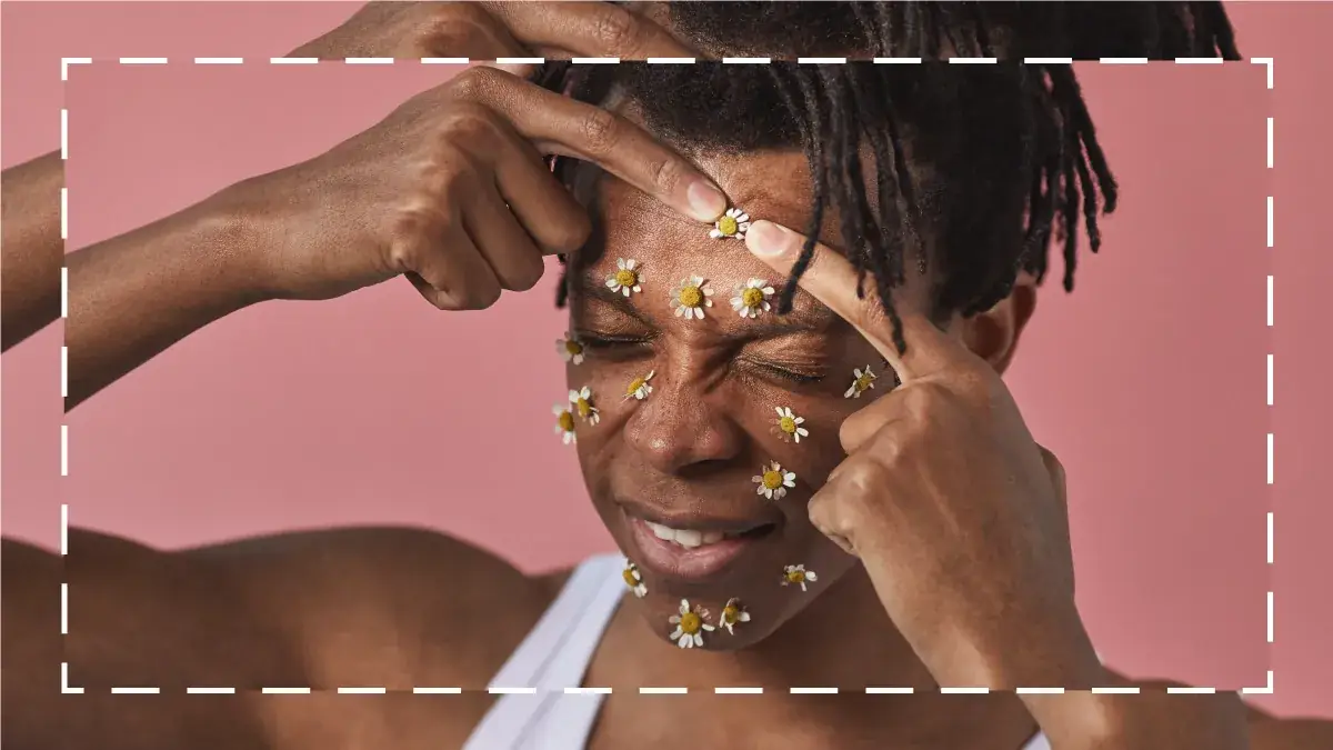 Here’s How to Zap Away Those Annoying Forehead Bumps 그림