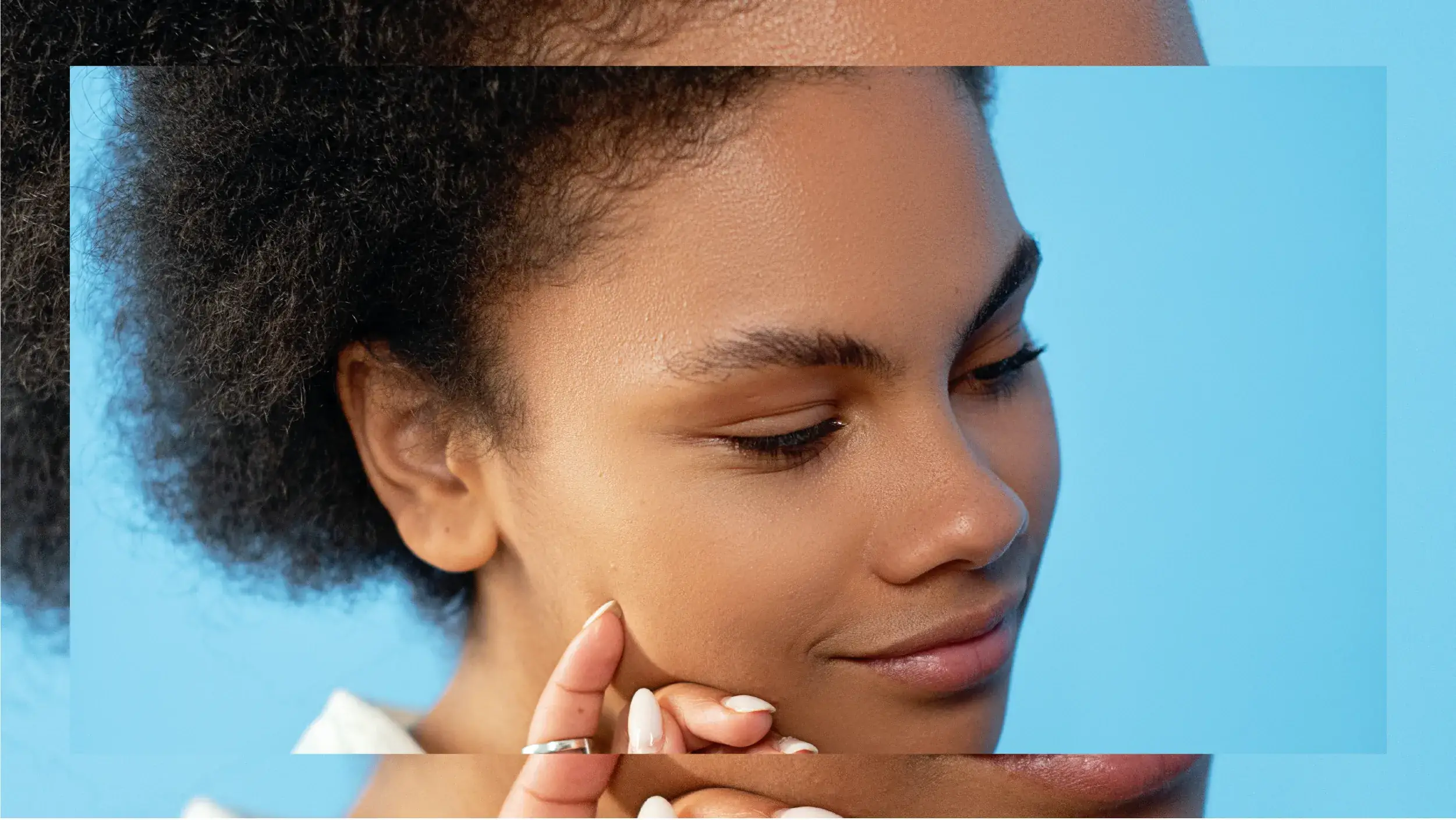 Do You Really Need…Products Specifically Made for Adult Acne? 그림